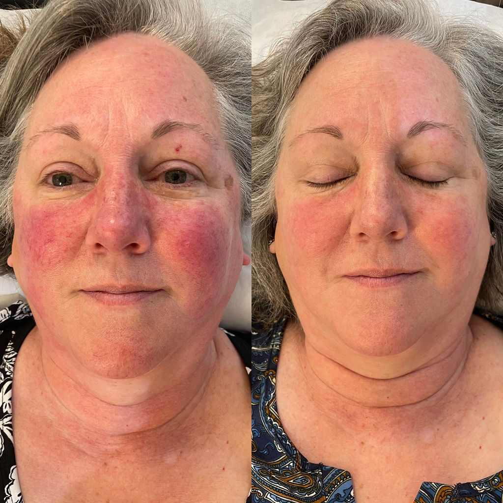 HALO before and after skin texture